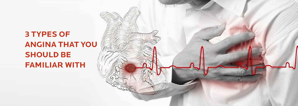 3 Types of Angina that You Should be Familiar with